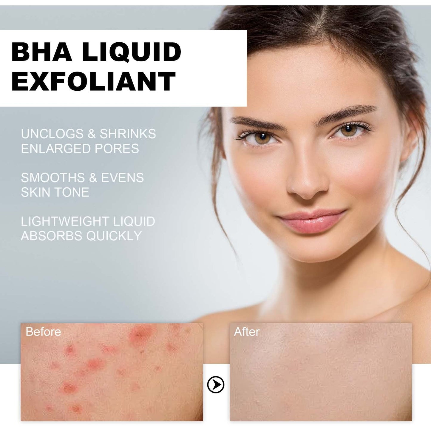 BHA Liquid Exfoliant, Lightening Acne Seal Pore-Tightening And Moisturizing Skin Essence