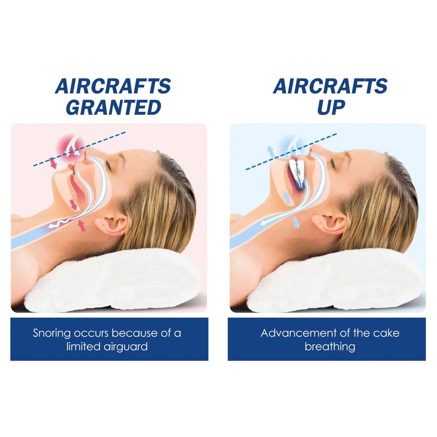 Adjustable Snoring Device, Correction At Night Help Sleep Cleaning Nasal Breathing Care Snore Stop Device