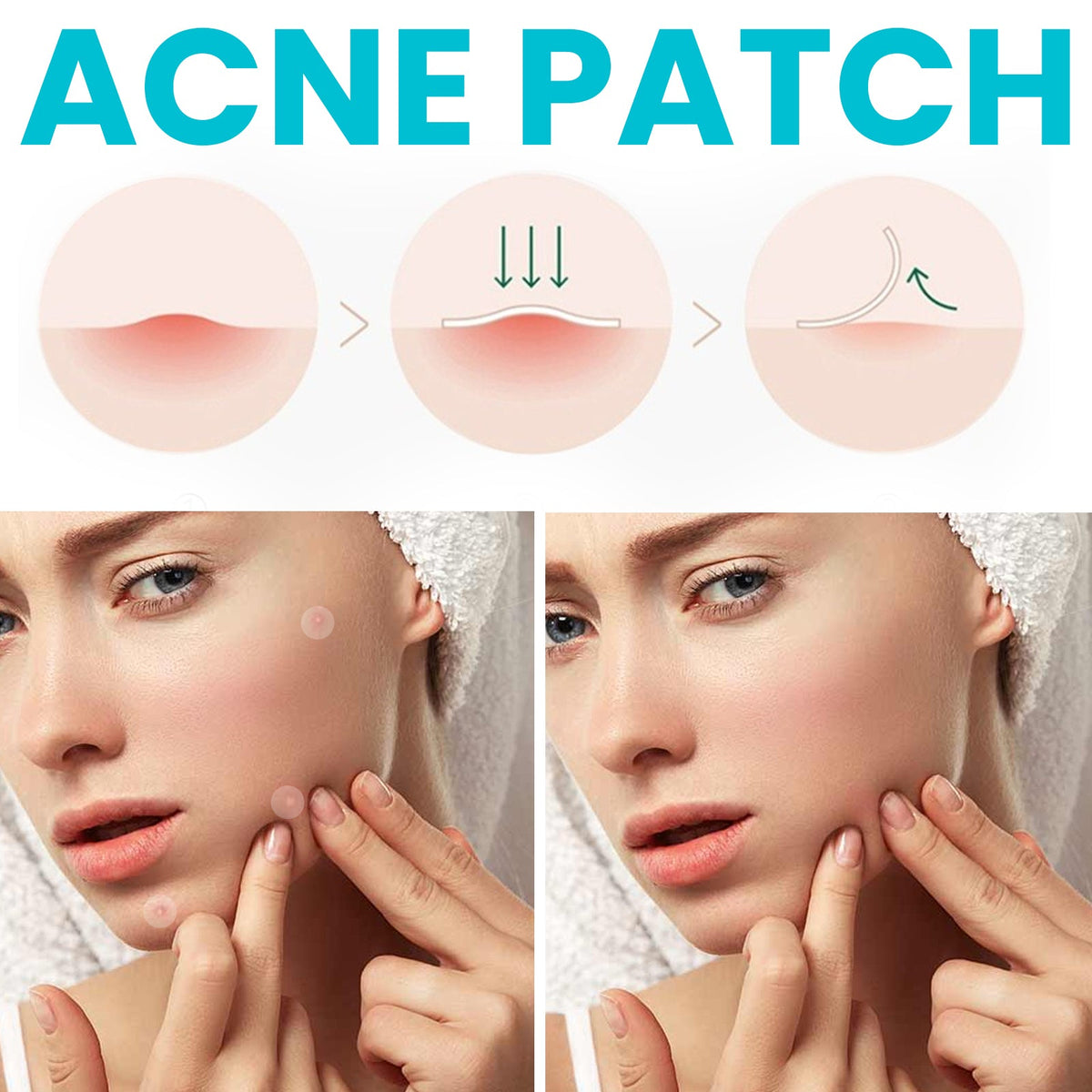 Acne Patch, Repair Facial Acne Invisible Concealer Hydrocolloid Patch ...