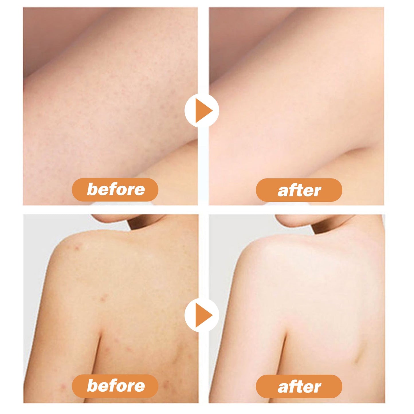 Cacao Body Lotion, Lightening Acne Mark Dark Hydrating Whitening Body Lotion